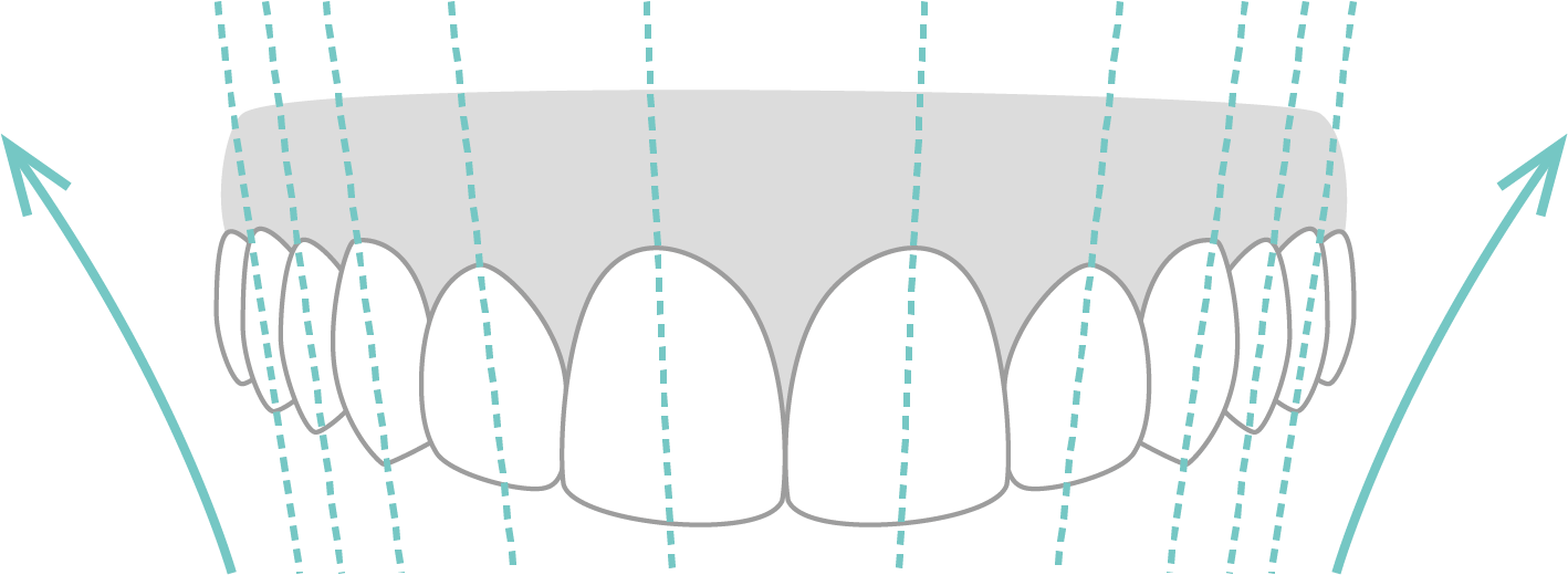 アキシャル・インクライネーション