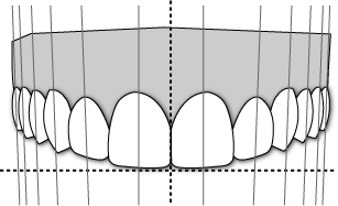 Axial Inclination